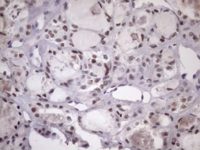 Immunohistochemistry (Formalin/PFA-fixed paraffin-embedded sections) - Anti-SFRS9/SRSF9 antibody [OTI5G7] (AB236414)