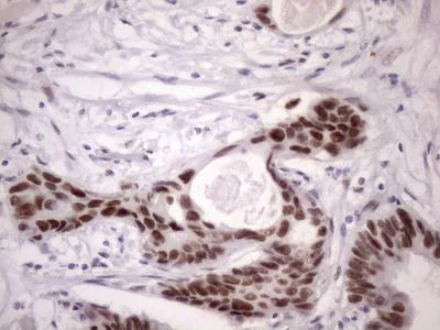 Immunohistochemistry (Formalin/PFA-fixed paraffin-embedded sections) - Anti-SFRS9/SRSF9 antibody [OTI5G7] (AB236414)