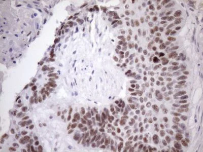 Immunohistochemistry (Formalin/PFA-fixed paraffin-embedded sections) - Anti-SFRS9/SRSF9 antibody [OTI5G7] (AB236414)