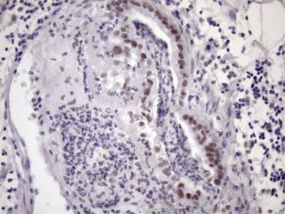 Immunohistochemistry (Formalin/PFA-fixed paraffin-embedded sections) - Anti-SFRS9/SRSF9 antibody [OTI5G7] (AB236414)