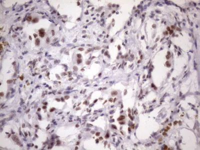 Immunohistochemistry (Formalin/PFA-fixed paraffin-embedded sections) - Anti-SFRS9/SRSF9 antibody [OTI5G7] (AB236414)