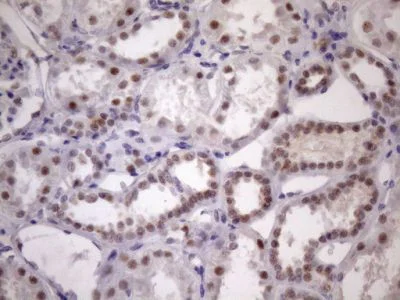 Immunohistochemistry (Formalin/PFA-fixed paraffin-embedded sections) - Anti-SFRS9/SRSF9 antibody [OTI5G7] (AB236414)