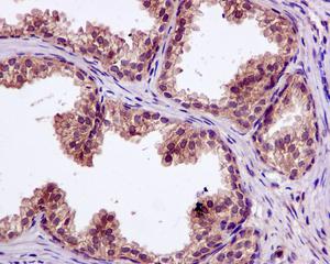 Immunohistochemistry (Formalin/PFA-fixed paraffin-embedded sections) - Anti-SFT antibody [EPR13000(B)] (AB176561)