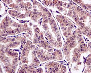 Immunohistochemistry (Formalin/PFA-fixed paraffin-embedded sections) - Anti-SFT antibody [EPR13000(B)] - BSA and Azide free (AB240192)