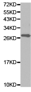 Western blot - Anti-SFTPA1 antibody (AB180865)