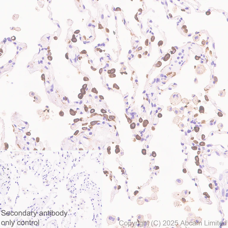 Immunohistochemistry (Formalin/PFA-fixed paraffin-embedded sections) - Anti-SFTPA1 antibody [EPR29098-90R] (AB325321)