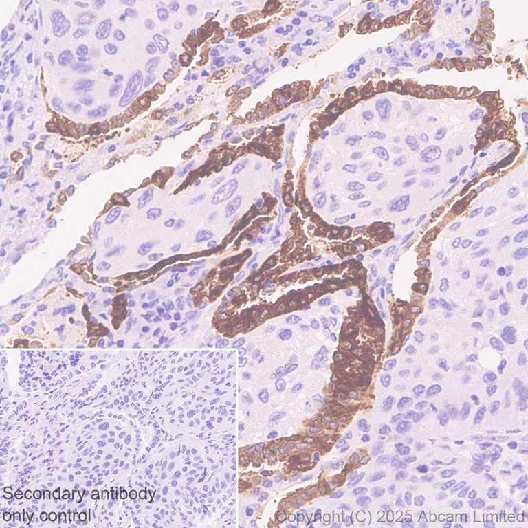 Immunohistochemistry (Formalin/PFA-fixed paraffin-embedded sections) - Anti-SFTPA1 antibody [EPR29098-90R] (AB325321)