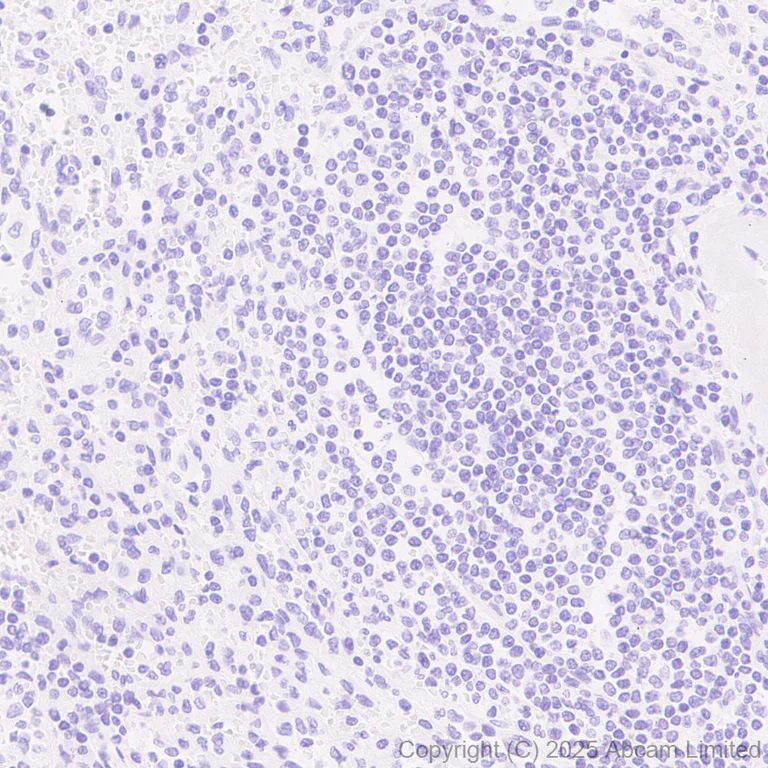 Immunohistochemistry (Formalin/PFA-fixed paraffin-embedded sections) - Anti-SFTPA1 antibody [EPR29098-90R] (AB325321)