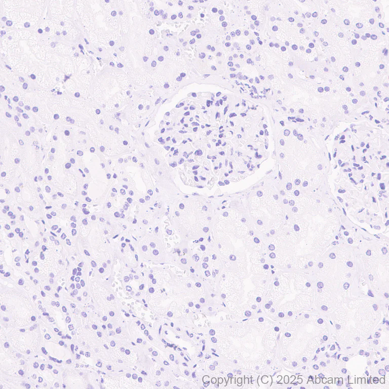 Immunohistochemistry (Formalin/PFA-fixed paraffin-embedded sections) - Anti-SFTPA1 antibody [EPR29098-90R] (AB325321)