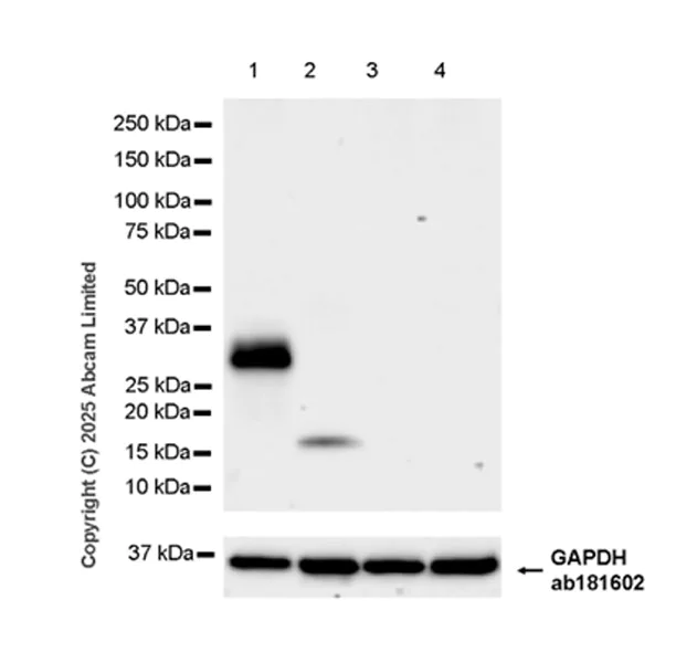Western blot - Anti-SFTPA1 antibody [EPR29098-90R] (AB325321)