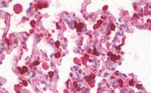 Immunohistochemistry (Formalin/PFA-fixed paraffin-embedded sections) - Anti-SFTPA1 + SFTPA2 antibody (AB190087)