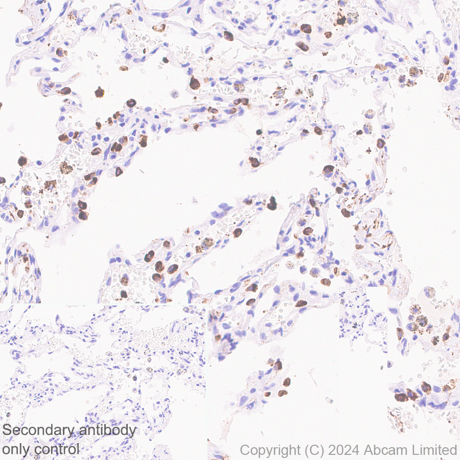 Immunohistochemistry (Formalin/PFA-fixed paraffin-embedded sections) - Anti-SFTPA1 + SFTPA2 antibody [EPR29098-6] (ab320648), expandable thumbnail