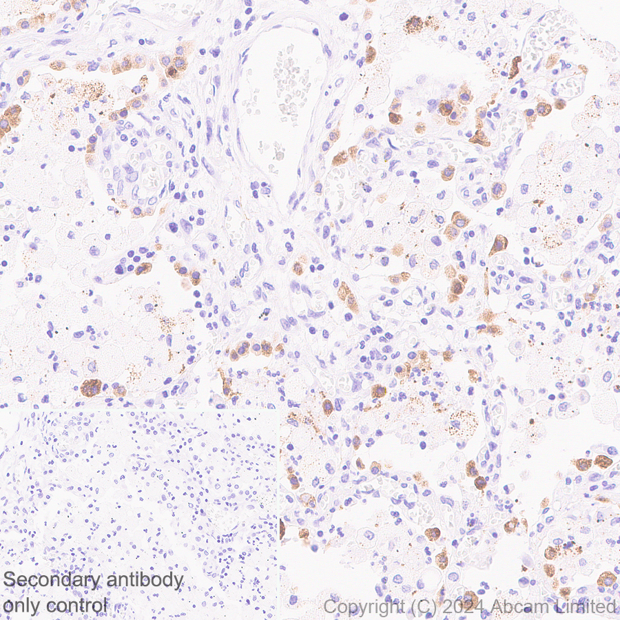 Immunohistochemistry (Formalin/PFA-fixed paraffin-embedded sections) - Anti-SFTPA1 + SFTPA2 antibody [EPR29098-6] (AB320648), expandable thumbnail