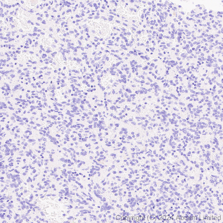 Immunohistochemistry (Formalin/PFA-fixed paraffin-embedded sections) - Anti-SFTPA1 + SFTPA2 antibody [EPR29098-6] (AB320648), expandable thumbnail