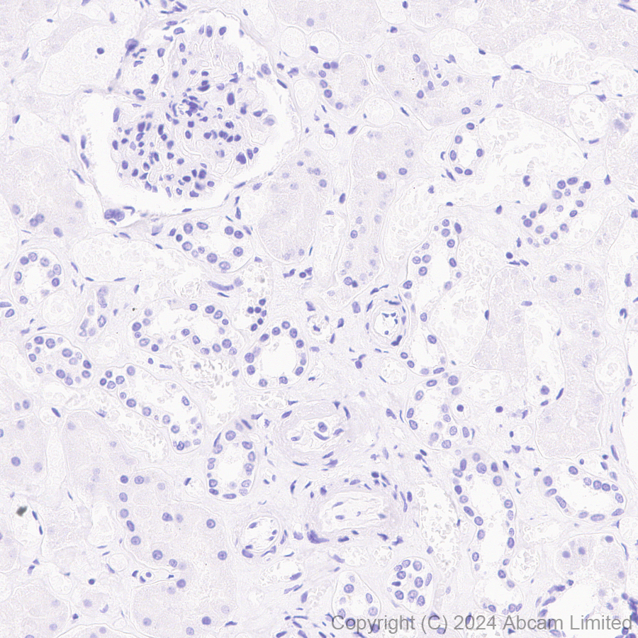 Immunohistochemistry (Formalin/PFA-fixed paraffin-embedded sections) - Anti-SFTPA1 + SFTPA2 antibody [EPR29098-6] (AB320648), expandable thumbnail