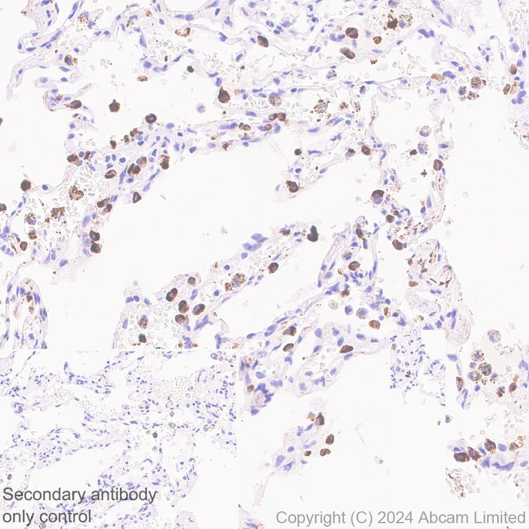 Immunohistochemistry (Formalin/PFA-fixed paraffin-embedded sections) - Anti-SFTPA1 + SFTPA2 antibody [EPR29098-6] - BSA and Azide free (AB320649)