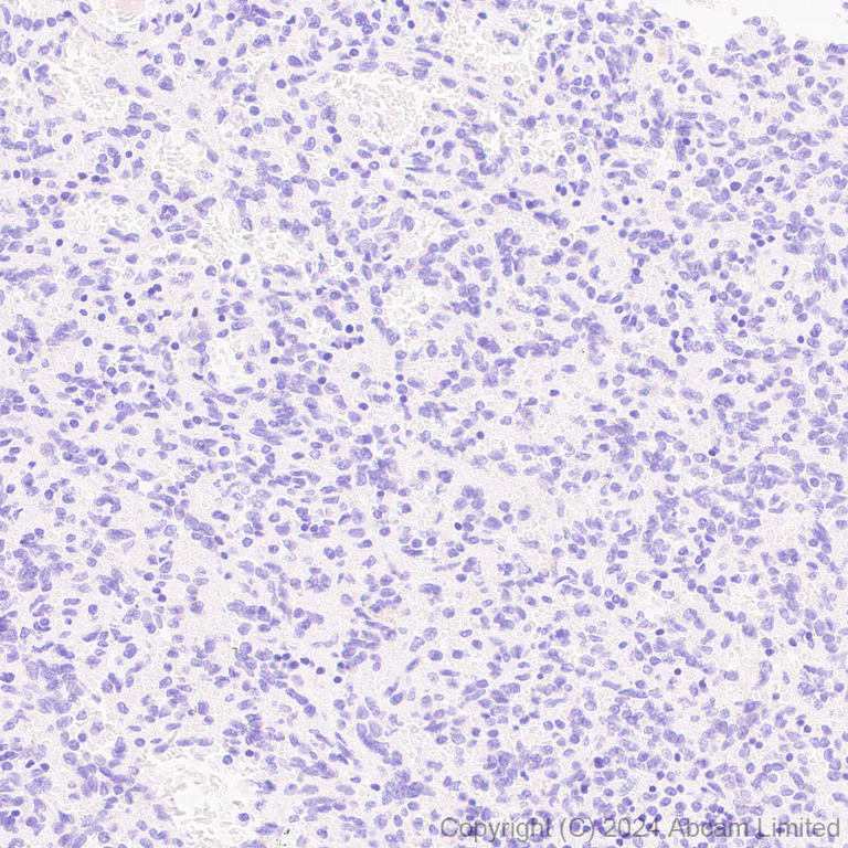 Immunohistochemistry (Formalin/PFA-fixed paraffin-embedded sections) - Anti-SFTPA1 + SFTPA2 antibody [EPR29098-6] - BSA and Azide free (AB320649)
