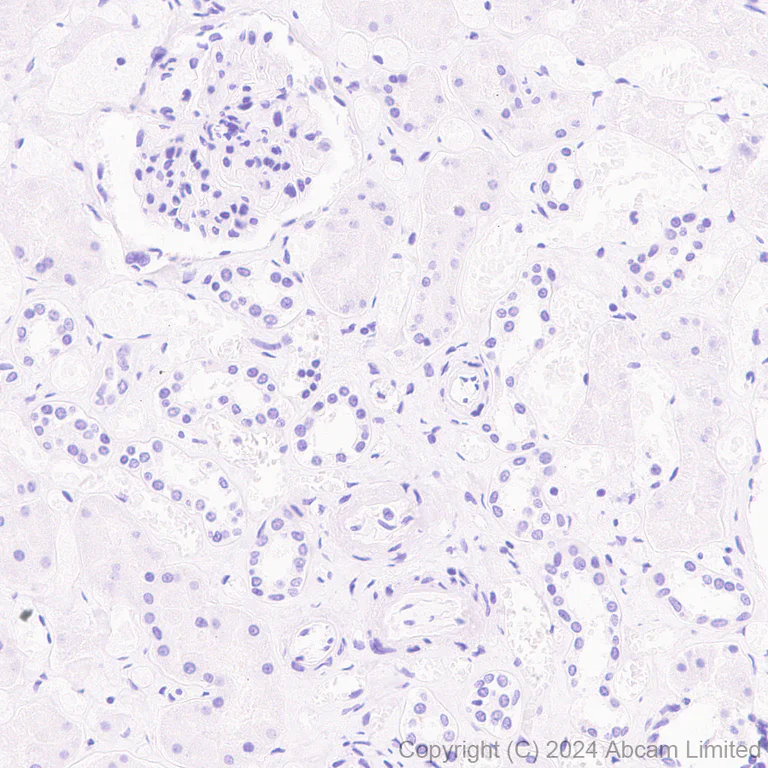 Immunohistochemistry (Formalin/PFA-fixed paraffin-embedded sections) - Anti-SFTPA1 + SFTPA2 antibody [EPR29098-6] - BSA and Azide free (AB320649)