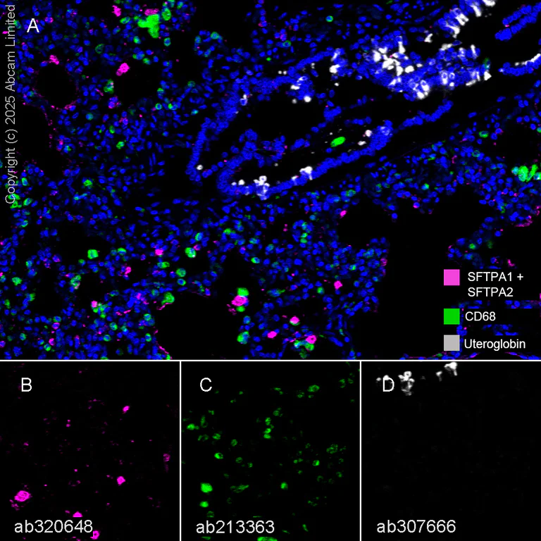 Multiplex immunohistochemistry - Anti-SFTPA1 + SFTPA2 antibody [EPR29098-6] - BSA and Azide free (AB320649)