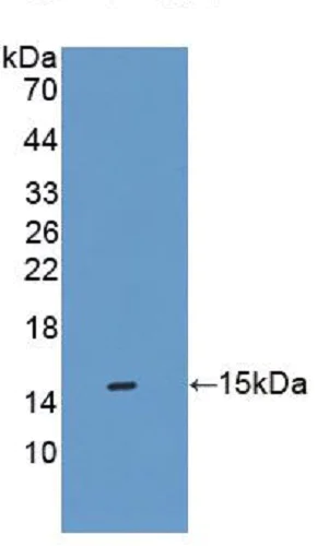 Western blot - Anti-SFXN1/TCC antibody (AB231256)