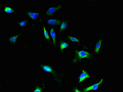 Immunocytochemistry/ Immunofluorescence - Anti-SFXN4 antibody (AB237804)