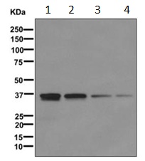 Western blot - Anti-SFXN5 antibody [EPR9532] (AB172971)