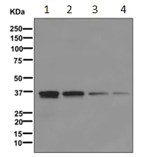 Western blot - Anti-SFXN5 antibody [EPR9532] - BSA and Azide free (AB249741)