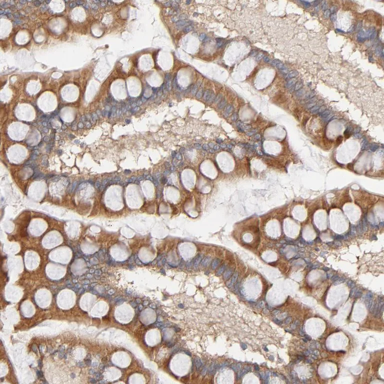 Immunohistochemistry (Formalin/PFA-fixed paraffin-embedded sections) - Anti-SG2NA antibody (AB254666)