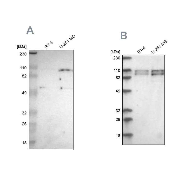 Western blot - Anti-SG2NA antibody (AB254666)