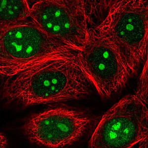 Immunocytochemistry/ Immunofluorescence - Anti-SGF29 antibody - N-terminal (AB204367)