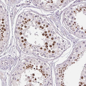 Immunohistochemistry (Formalin/PFA-fixed paraffin-embedded sections) - Anti-SGF29 antibody - N-terminal (AB204367)