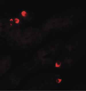Immunocytochemistry/ Immunofluorescence - Anti-SGK1 antibody (AB156637)