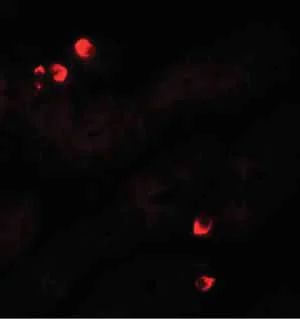 Immunocytochemistry/ Immunofluorescence - Anti-SGK1 antibody (AB156637)