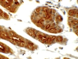 Immunohistochemistry (Formalin/PFA-fixed paraffin-embedded sections) - Anti-SGK1 antibody (AB156637)