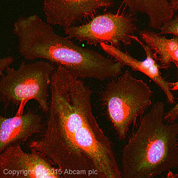Immunocytochemistry/ Immunofluorescence - Anti-SGK1 antibody (AB43606)