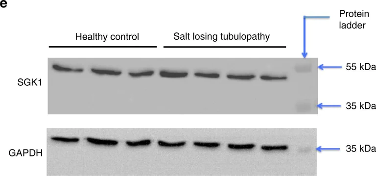 Western blot - Anti-SGK1 antibody (AB43606)