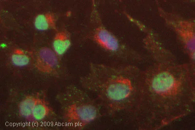Immunocytochemistry/ Immunofluorescence - Anti-SGK1 antibody (AB59337)