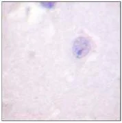 Immunohistochemistry (Formalin/PFA-fixed paraffin-embedded sections) - Anti-SGK1 antibody (AB59337)