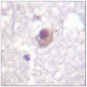Immunohistochemistry (Formalin/PFA-fixed paraffin-embedded sections) - Anti-SGK1 antibody (AB59337)