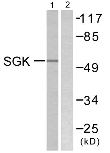 Western blot - Anti-SGK1 antibody (AB59337)