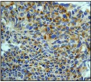 Immunohistochemistry (Formalin/PFA-fixed paraffin-embedded sections) - Anti-SGK1 antibody [Y238] (AB32374)
