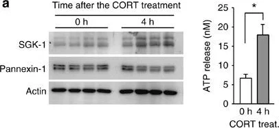 Western blot - Anti-SGK1 antibody [Y238] (AB32374)