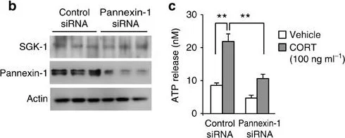 Western blot - Anti-SGK1 antibody [Y238] (AB32374)