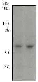 Western blot - Anti-SGK1 antibody [Y238] (AB32374)