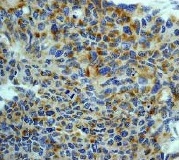 Immunohistochemistry (Formalin/PFA-fixed paraffin-embedded sections) - Anti-SGK1 antibody [Y238] - BSA and Azide free (AB239812)