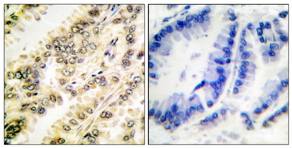 Immunohistochemistry (Formalin/PFA-fixed paraffin-embedded sections) - Anti-SGK1 (phospho S422) antibody (AB55281)