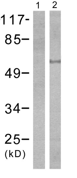 Western blot - Anti-SGK1 (phospho S422) antibody (AB55281)
