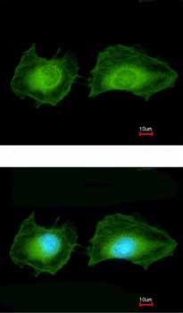 Immunocytochemistry/ Immunofluorescence - Anti-SGK3 antibody (AB153981), expandable thumbnail