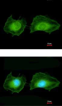 Immunocytochemistry/ Immunofluorescence - Anti-SGK3 antibody (AB153981)