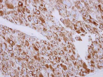 Immunohistochemistry (Formalin/PFA-fixed paraffin-embedded sections) - Anti-SGK3 antibody (AB153981)